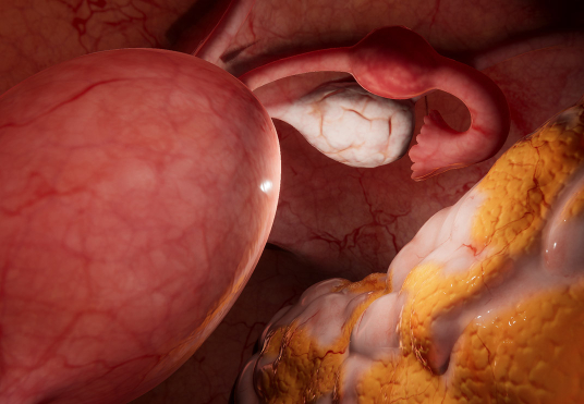 Now Available: Laparoscopic Salpingectomy